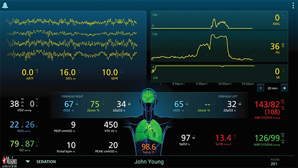 Masimo - UniView - Sedation Layout